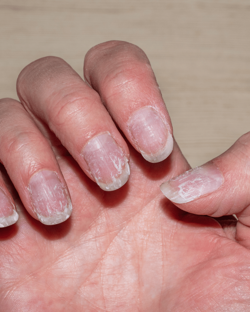 Close-up of a hand showing unpolished, short nails with visible wear and a few minor imperfections.