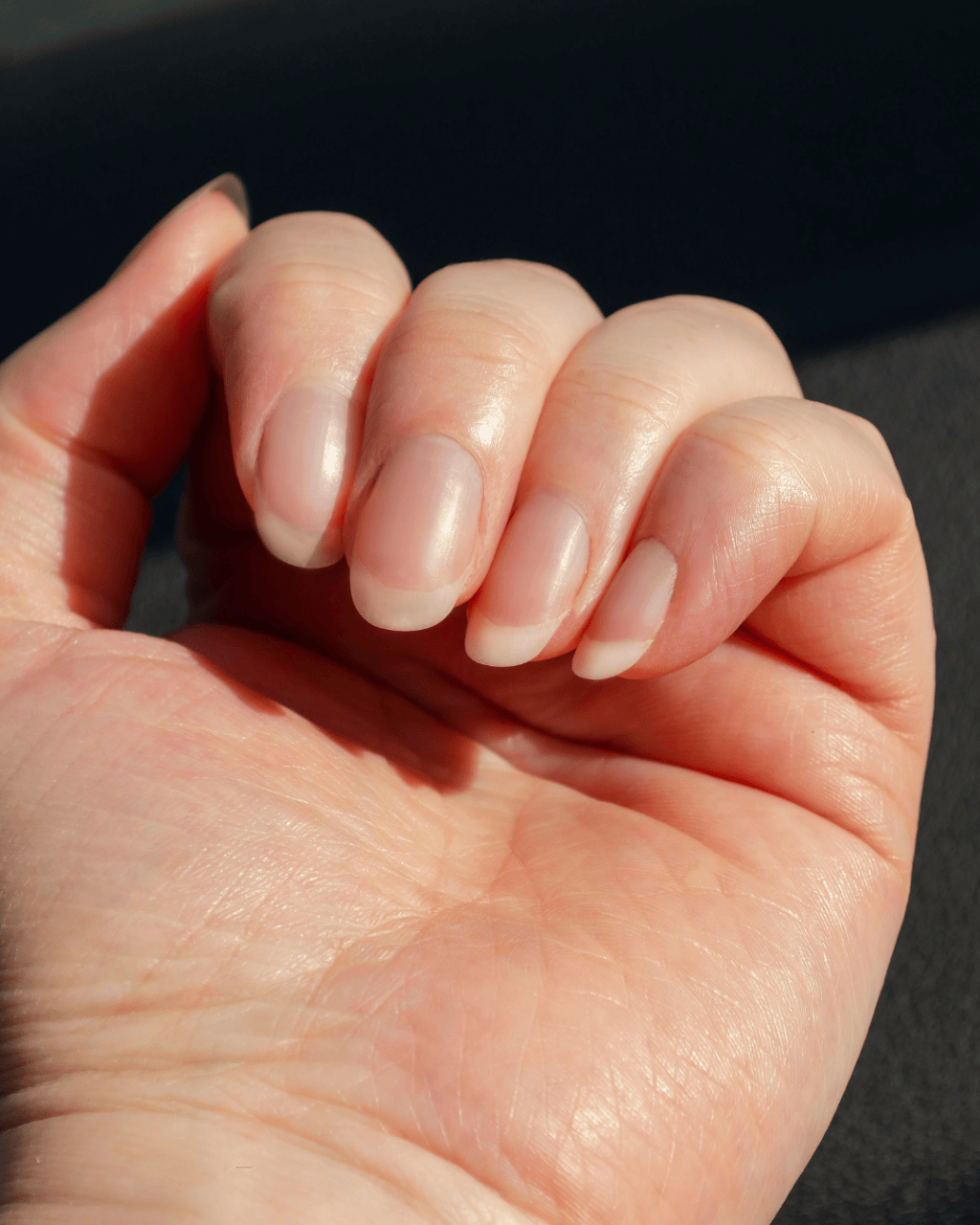 Strong, Brittle Or Breaking? A Guide To Healthy&nbsp;Nails